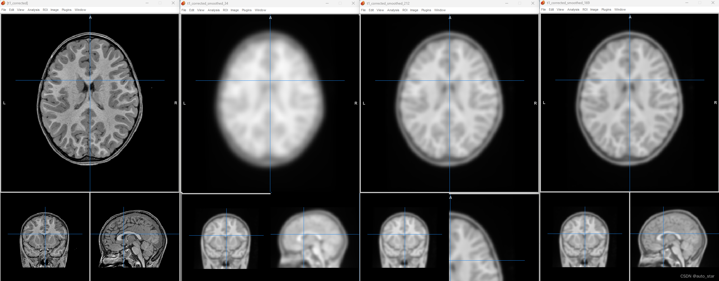 MR image smoothing or filtering 既 FWHM与sigma之间的换算关系 fslmaths -s参数