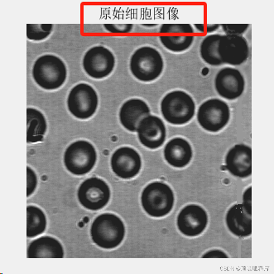 2-24 基于图像处理的细胞计数方法