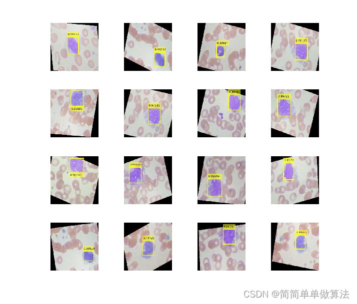 基于yolov2深度学习网络的血细胞检测算法matlab仿真