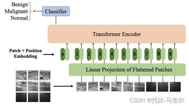 5.10.6 用于乳腺癌超声图像分类的Vision Transformer