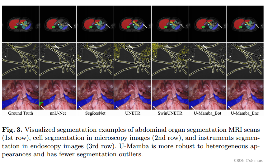 U-Mamba: Enhancing Long-range Dependency for Biomedical Image Segmentation