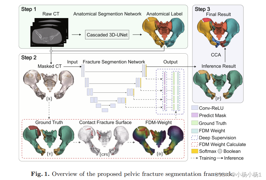 基于<span style='color:red;'>多</span><span style='color:red;'>尺度</span>距离加权神经网络的骨盆骨折<span style='color:red;'>分割</span>