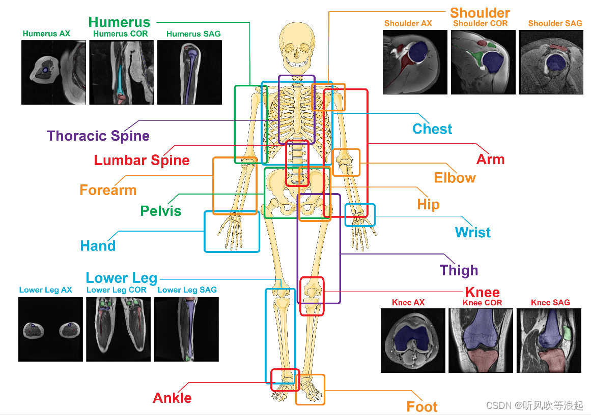 第二章：SegmentAnyBone 分割一切骨头视觉大模型介绍