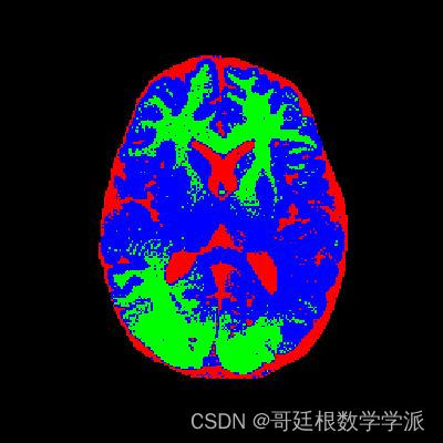 MATLAB环境下基于偏置场校正的改进模糊c-均值聚类图像分割算法