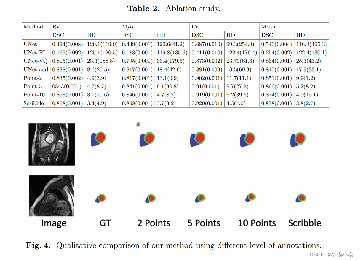 Minimal-Supervised Medical Image Segmentation via Vector Quantization Memory