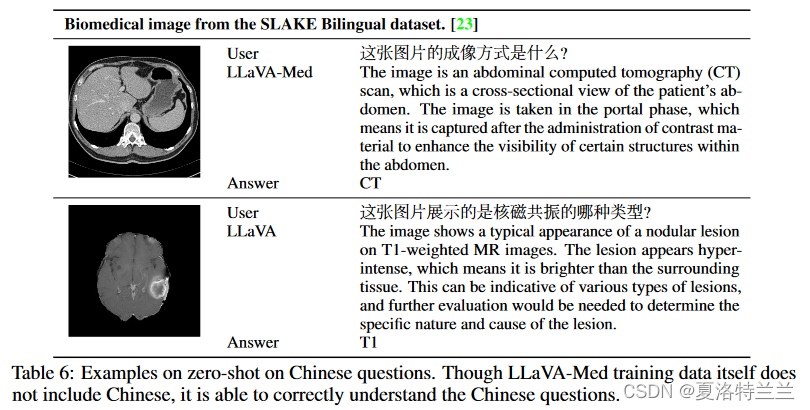 LLaVA-Med 论文阅读笔记