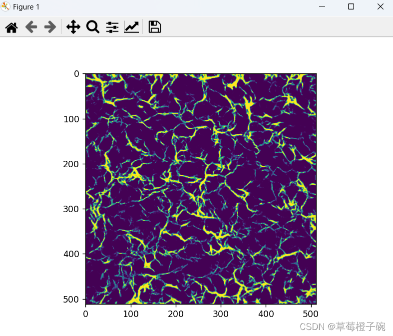 VGAN实现视网膜图像血管分割（基于pytorch）