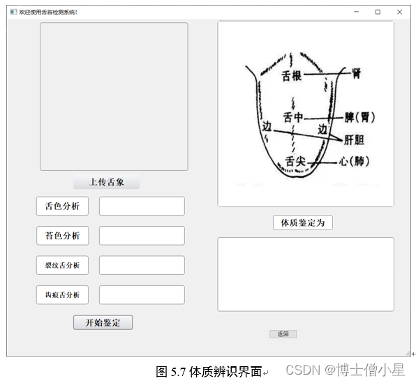 人工智能|机器学习——基于机器学习的舌苔检测