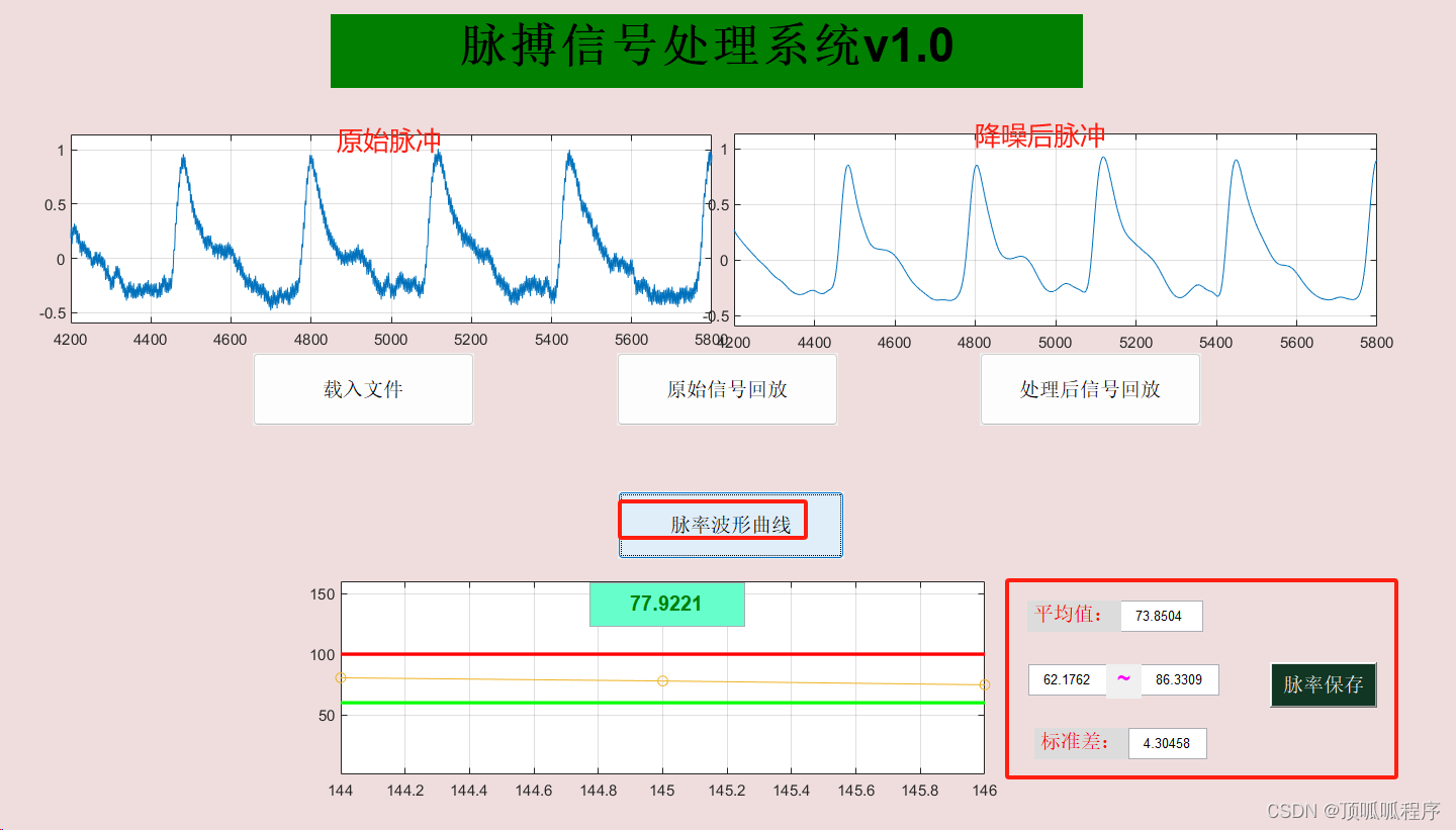 275 基于matlab的脉搏信号处理GUI界面编程