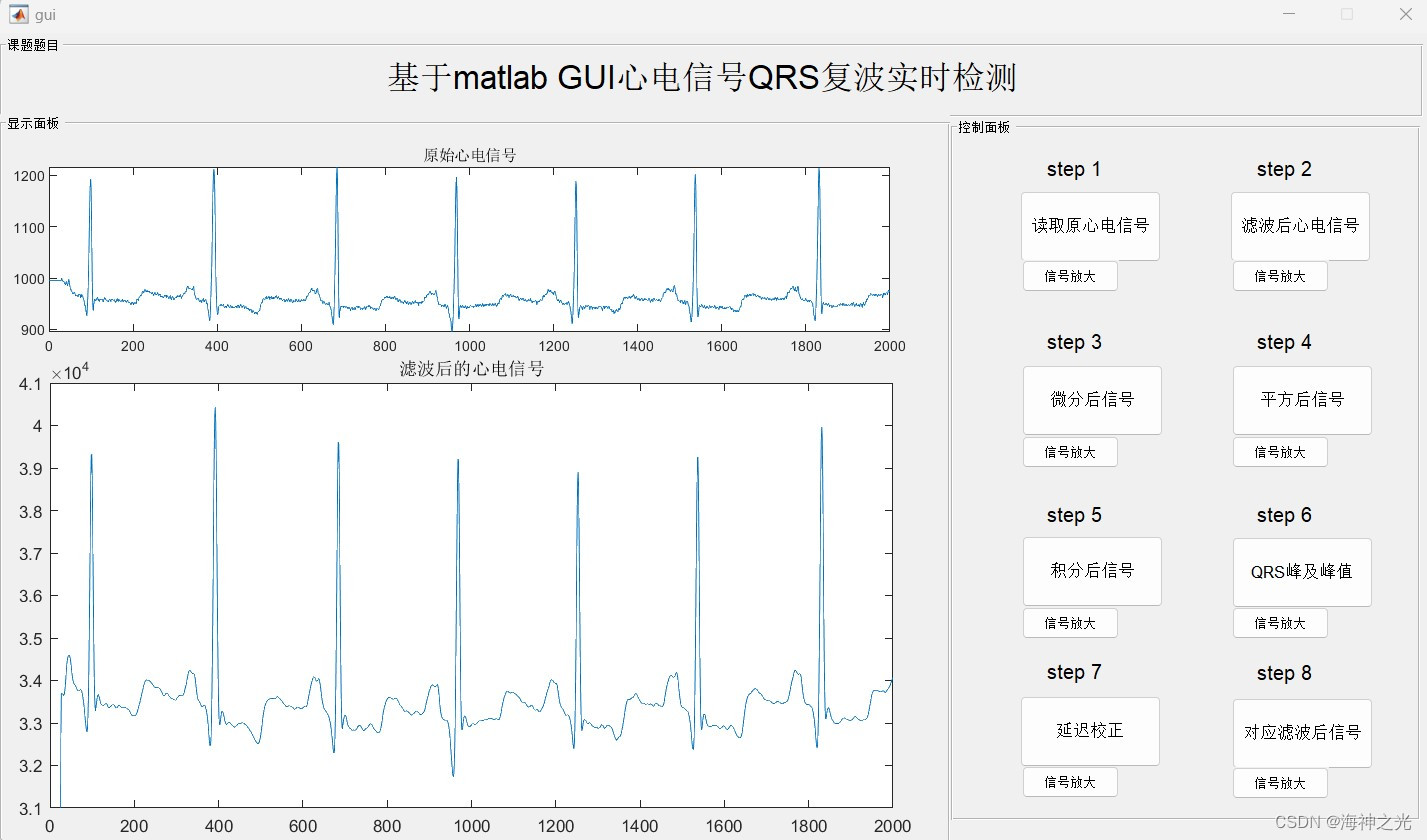 【<span style='color:red;'>心</span><span style='color:red;'>电信号</span>ECG】<span style='color:red;'>心</span><span style='color:red;'>电信号</span><span style='color:red;'>QRS</span>复波实时<span style='color:red;'>检测</span>【含GUI <span style='color:red;'>Matlab</span>源码 4334期】