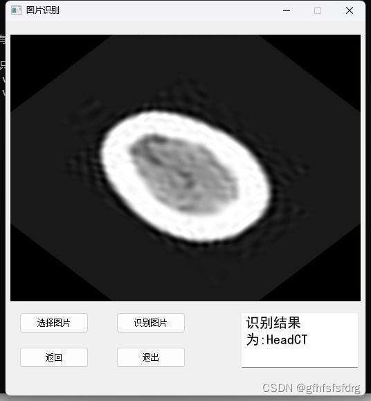 0073期通过CNN卷积网络识别CT图-含数据集_cnn识别轮廓 ct图像-CSDN博客