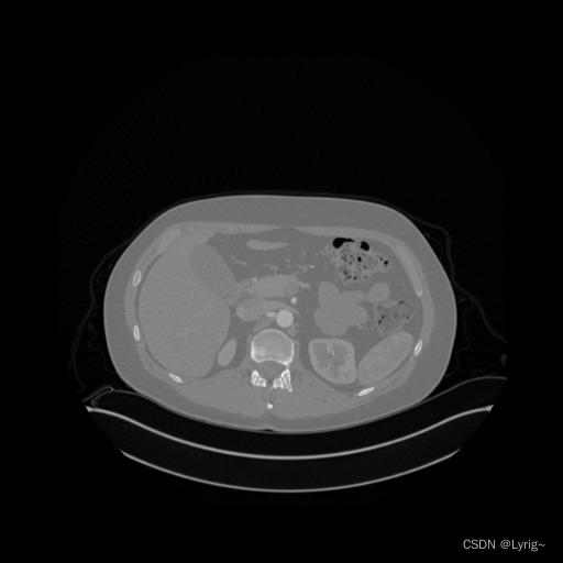 Python库使用介绍 LivermorE AI Projector for Computed Tomography LEAP