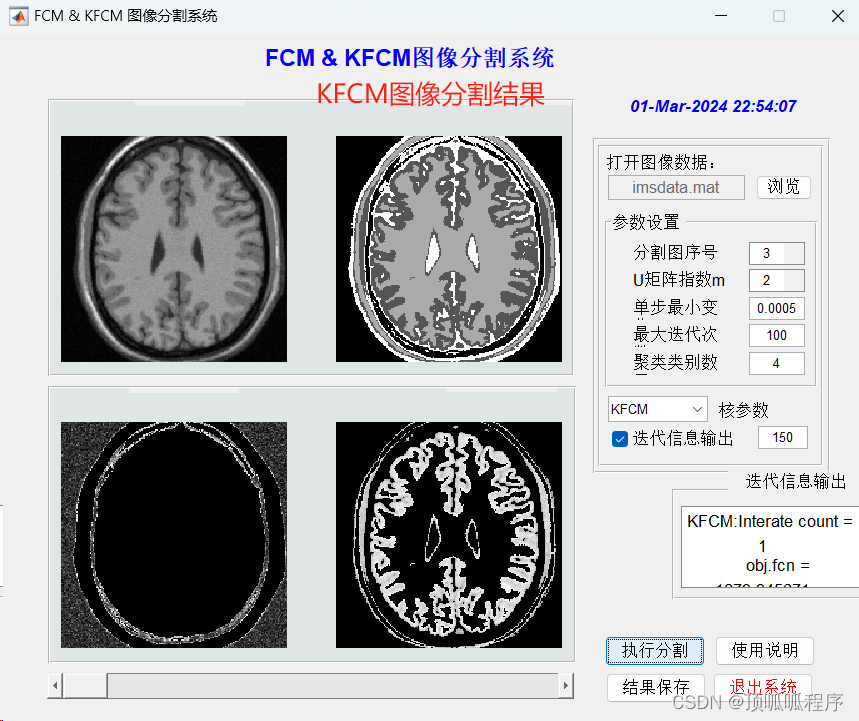 266 基于matlab的FCM+KFCM模糊C均值聚类分析算法