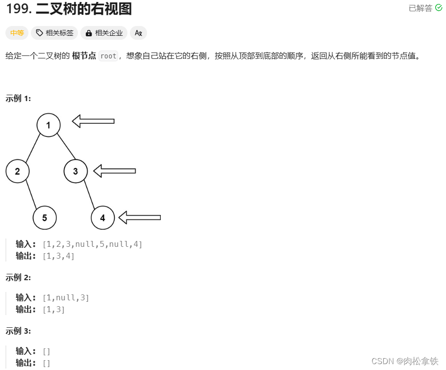 代码随想录——二叉树的右视图（Leetcode199）