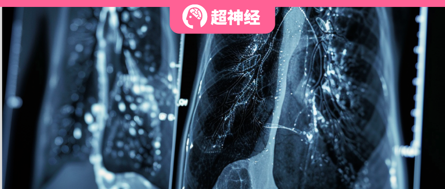 基于美日 627 例患者的临床数据，谷歌证实 AI 辅助肺癌筛查的群体有效性