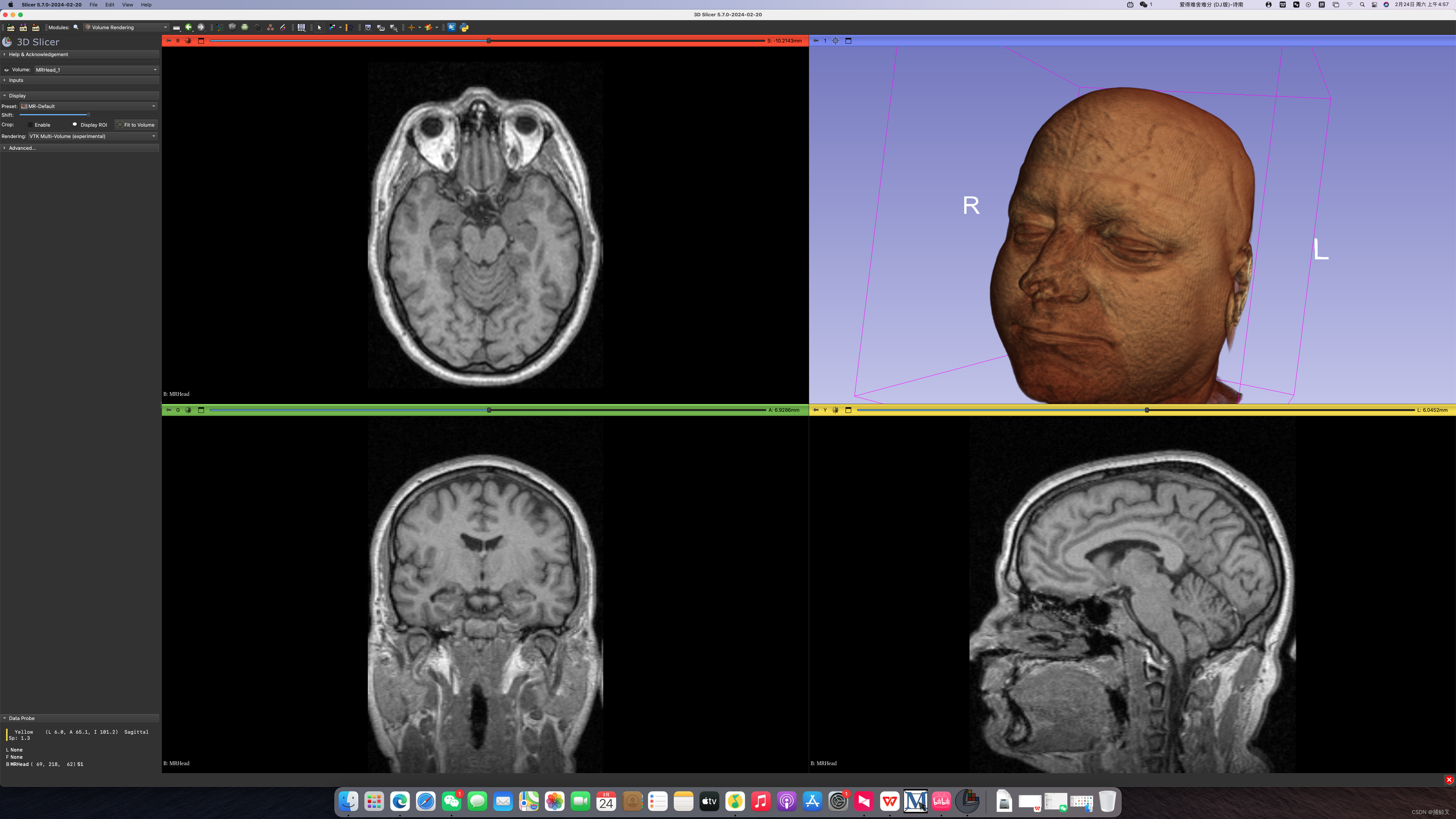 3d Slicer软件一种新的体绘制方式