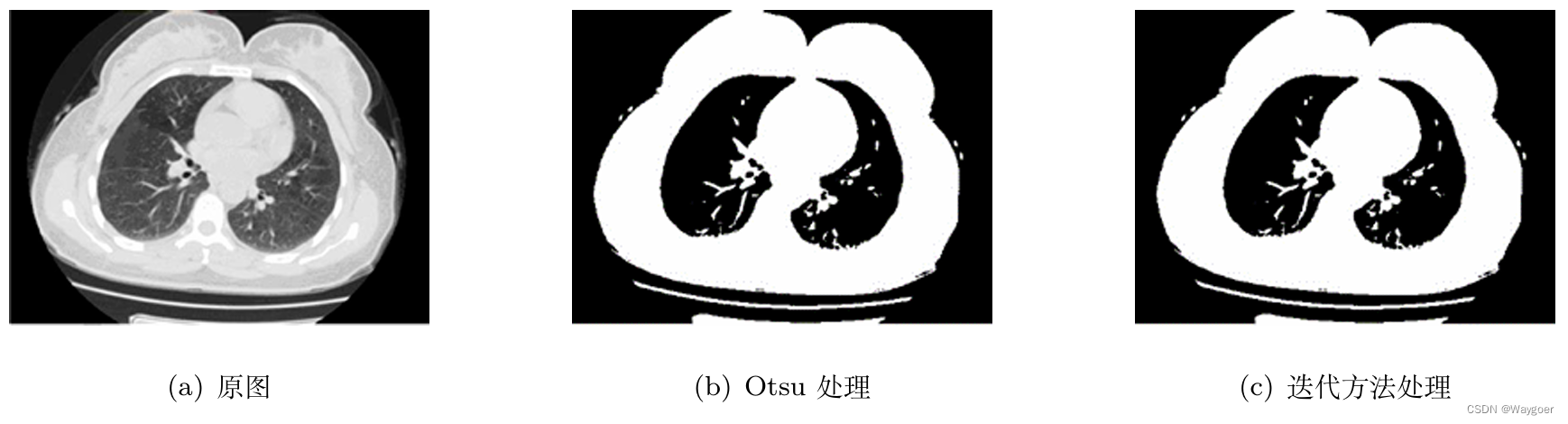 【图像分割】使用Otsu 算法及迭代计算最佳全局阈值估计并实现图像分割（代码实现与分析）