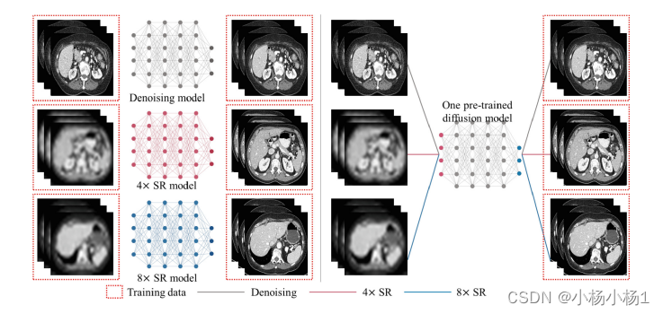 预训练扩散模型用于即插即用的医学图像增强