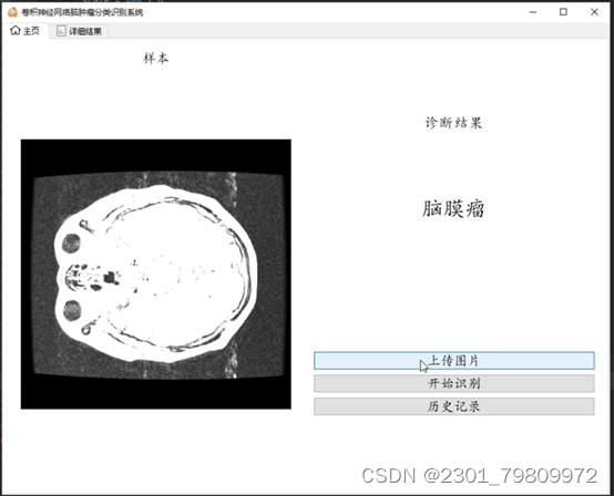 深度学习之基于Tensorflow卷积神经网络脑肿瘤分类识别系统