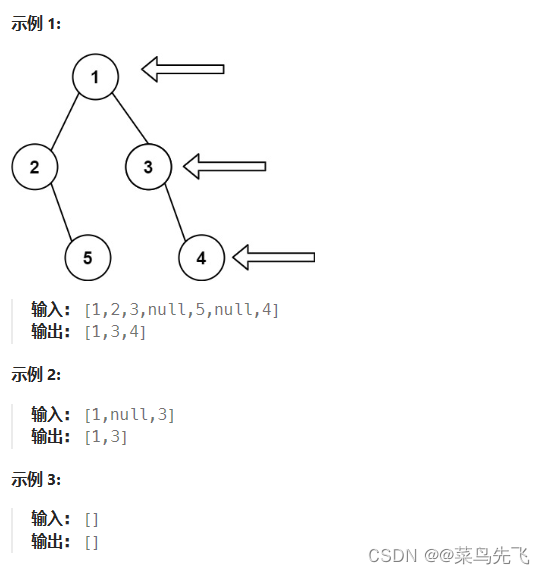 【199.二叉树的右视图】_二叉树_day01