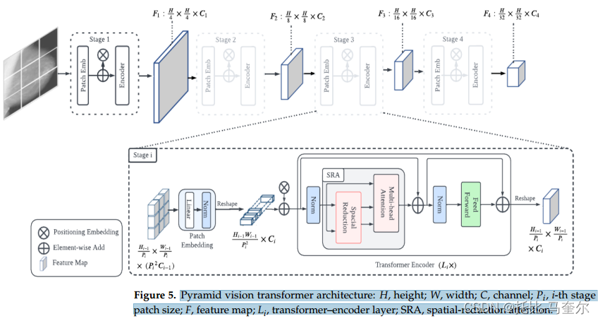 基于Vision Transformer的迁移学习在乳腺X光图像分类中的应用