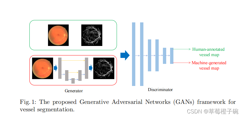 VGAN实现视网膜图像血管分割（基于pytorch）