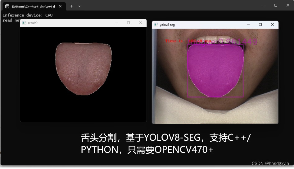 舌头分割YOLOV<span style='color:red;'>8</span>-<span style='color:red;'>SEG</span>