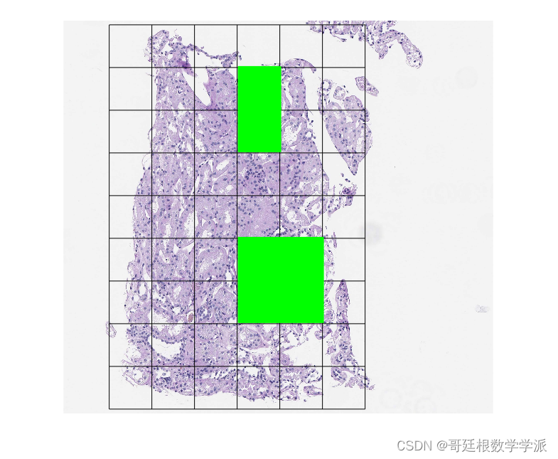 MATLAB环境下基于图像处理的计算病理学图像分割（MATLAB R2021B）