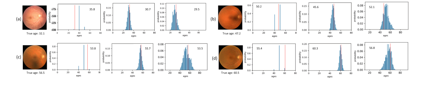 【早期疾病诊断 + 个性化医疗】通过 fundus 图，预测视网膜年龄