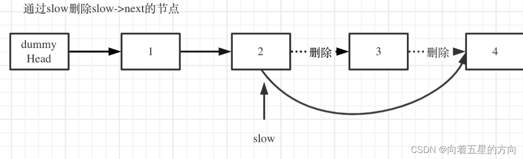 刷题之Leetcode19题(超级详细)