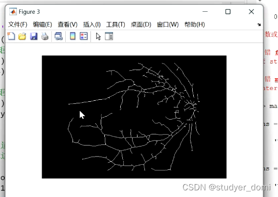 matlab 眼球图像处理血管提取