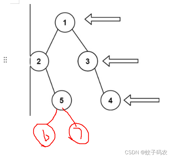 算法题解记录24+++二叉树的右视图（百日筑基）