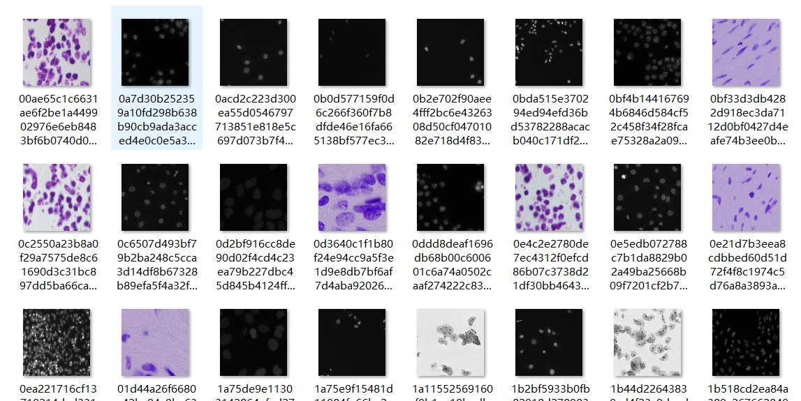 图像分割实战-系列教程3：unet医学细胞分割实战1（医学数据集、图像分割、语义分割、unet网络、代码逐行解读）