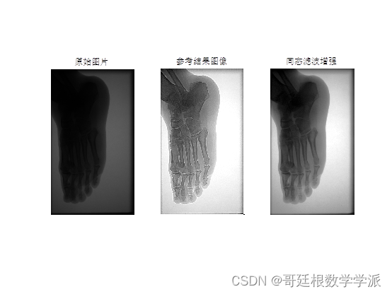 MATLAB环境下基于同态滤波方法的医学图像增强