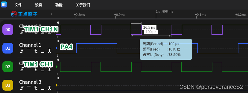 STM32G4 TIM1触发ADC转换