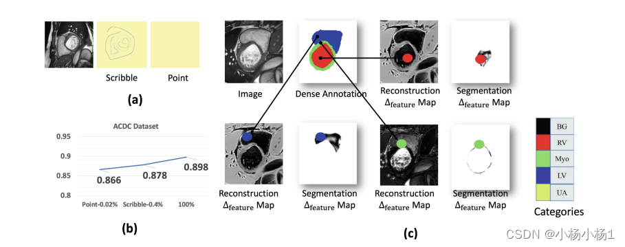 Minimal-Supervised Medical Image Segmentation via Vector Quantization Memory