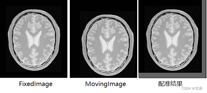 【ITK配准】第十期 进化优化配准样例