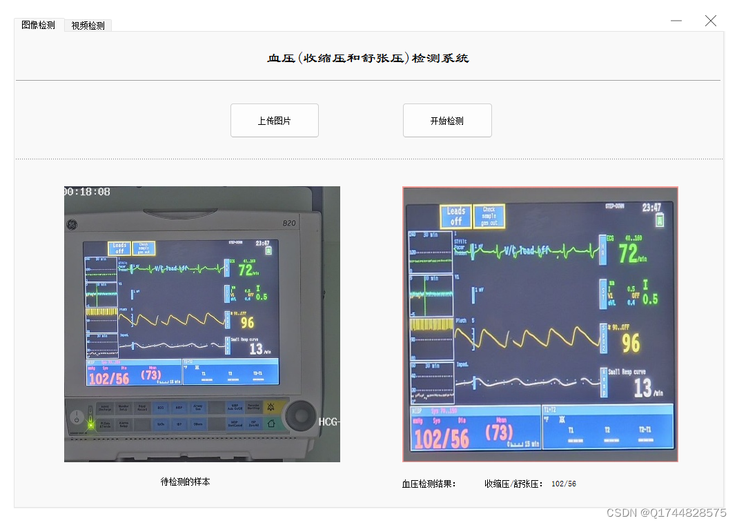 深度学习之基于YOLOv5+OCR+正则匹配的血压(收缩压和舒张压)检测系统