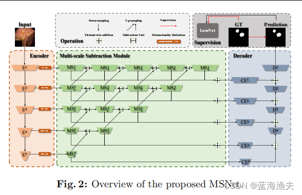 图像分割论文阅读：Automatic Polyp Segmentation via Multi-scale Subtraction Network