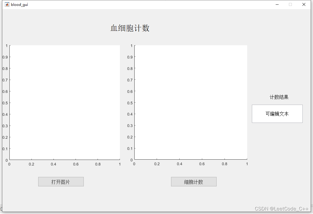 基于Matlab的细胞计数图像处理系统(GUI界面&&有报告) 【含Matlab源码 MX_003期】