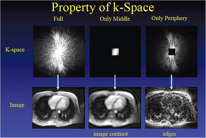 MRI基础--k空间