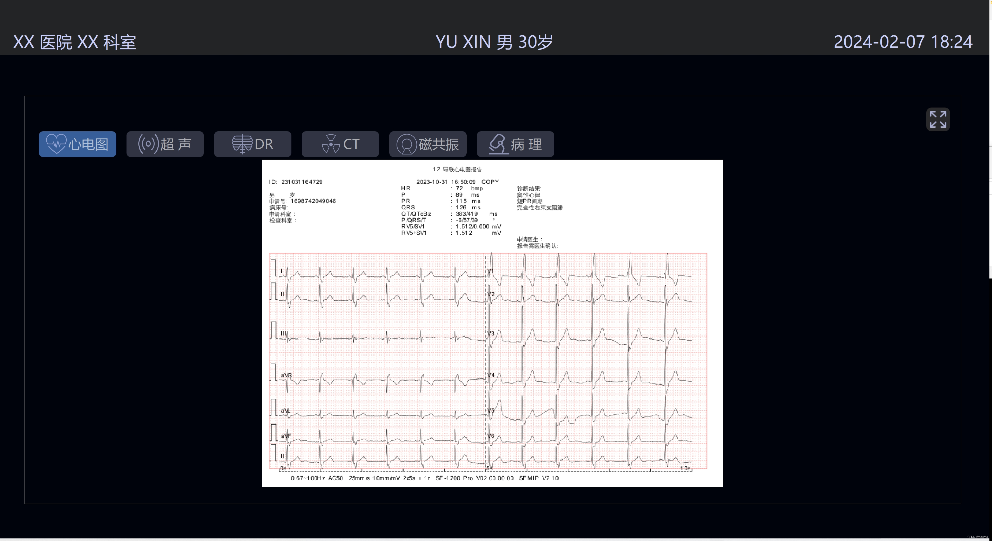 Qt Windows和Android使用<span style='color:red;'>MuPDF</span>预览PDF文件