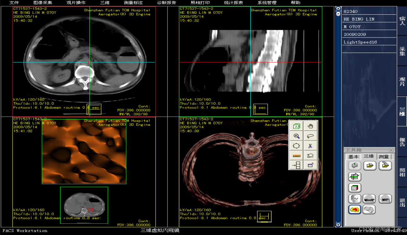 C/S架构，集成三维影像后处理功能，自主版权的一套医院PACS系统源码