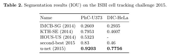 U-Net: Convolutional Networks for Biomedical Image Segmentation--论文笔记