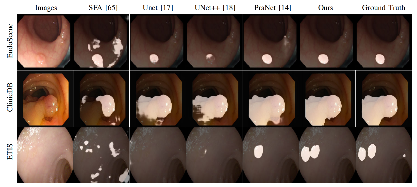 【论文阅读】MCANet: Medical Image Segmentation with Multi-Scale Cross-Axis Attention