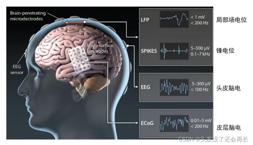 【脑电信号处理与特征提取】P5-彭薇薇：脑电信号的预处理及数据分析要点