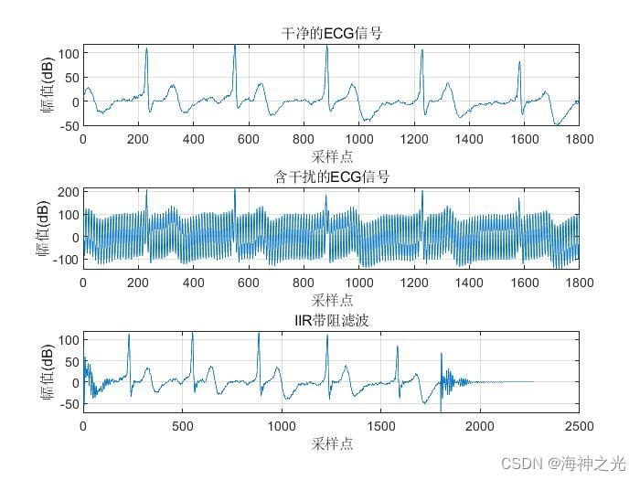 【心电信号ecg】iir和fir滤波器心电图信号去噪(低通 带阻 高通)【含