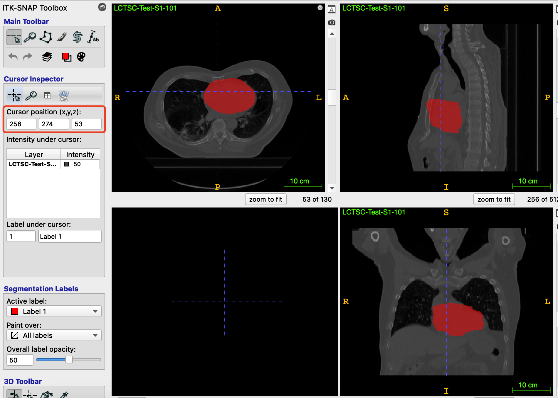 DICOM-RT struct在python中显示mask以及使用3d Slicer转换为nii_吨吨不打野的博客-CSDN博客