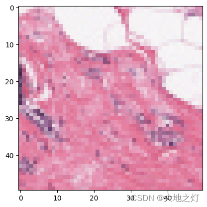 pytorch 入门 （五）案例三：乳腺癌识别识别-VGG16实现