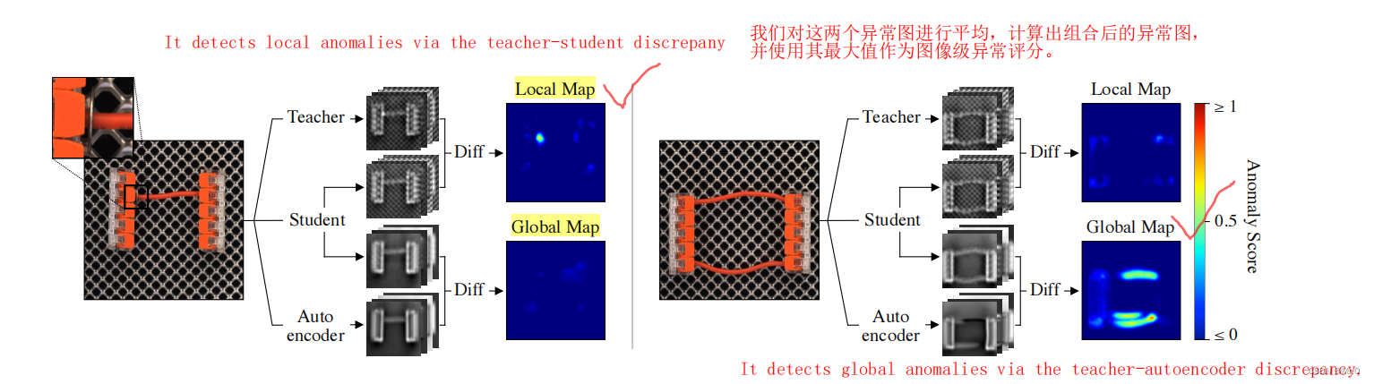 efficientAD 源码阅读